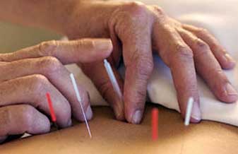 Kim Acupuntura - Foto 1