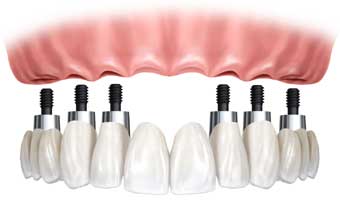 Dr Marcelo Paraguassú de Carvalho - Foto 1